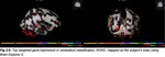Revealing Location-Specific Variation and Drug Transport Specificity in the Allen Brain Atlas